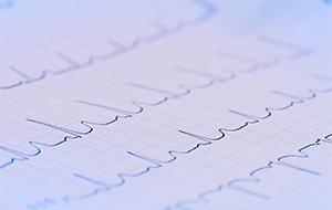 ekg
