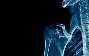 xray of skeleton